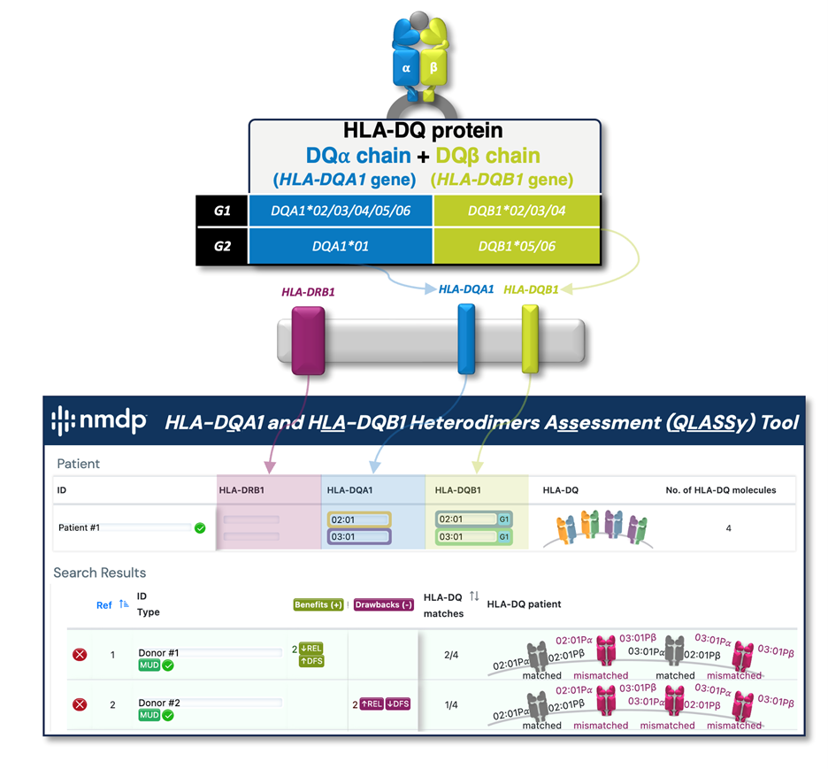 HLA-DQ Heterodimers Tool to Enhance Donor Selection by Lowering Relapse Risk